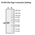 HMGB1, Avi-His-Tag Recombinant – Figure 1 of 1