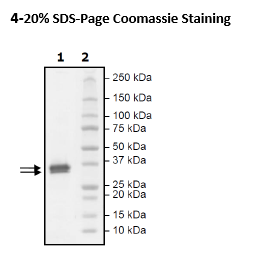 HMGB1, Avi-His-Tag Recombinant – Figure 1 of 1