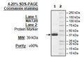 MAT2B, His-Tag Recombinant – Figure 1 of 1
