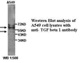 Anti-TGFβ1 Antibody – Figure 1 of 1