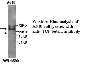 Anti-TGFβ1 Antibody – Figure 1 of 1