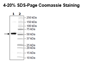 FTO, His-Tag Recombinant – Figure 1 of 2