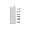 PDPN, Fc-Fusion, Avi-Tag, Biotin-Labeled HiP™ Recombinant – Figure 1 of 2