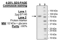 B7-H6, Fc-Fusion-Avi-Tag (Human) Recombinant – Figure 1 of 1