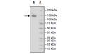 4-20% SDS-PAGE Coomassie Staining