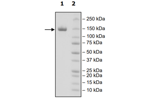 4-20% SDS-PAGE Coomassie Staining