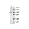 CD19, Fc-Fusion (IgG1), Avi-Tag, Biotin-Labeled Recombinant – Figure 1 of 2