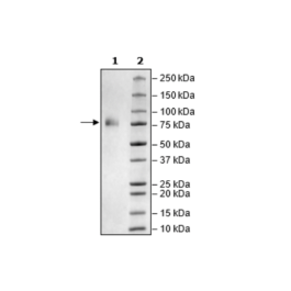 CD19, Fc-Fusion (IgG1), Avi-Tag, Biotin-Labeled Recombinant – Figure 1 of 2