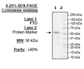 FTO, His-Tag (Sf9 derived) Recombinant – Figure 1 of 2