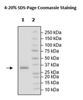 JAK2 (V617F, W659A, W777A, F794H), His-Avi-Tag, Biotin-Labeled Recombinant – Figure 1 of 4
