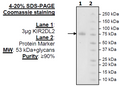 KIR2DL2 Fc-fusion, Avi-Tag HiP™ Recombinant – Figure 1 of 2