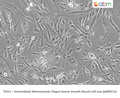 Immortalized Atherosclerotic Plaque Human Smooth Muscle Cell Line (pdSMC1A) | Applied Biological Materials (abm)