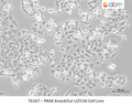 PAX6 KnockOut U251N Cell Line | Applied Biological Materials (abm)