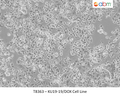 KU19-19/DOX Cell Line | Applied Biological Materials (abm)