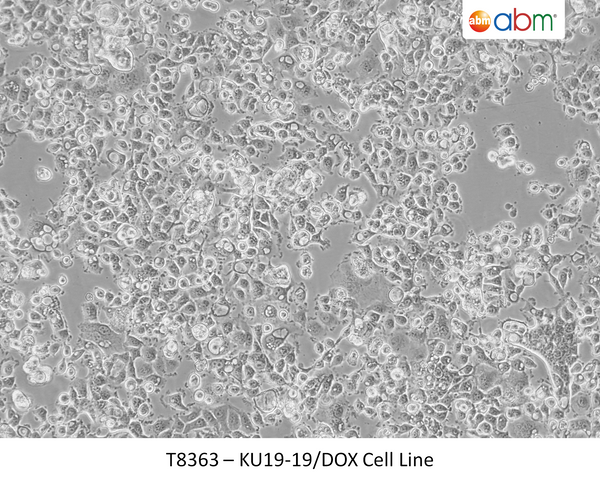 KU19-19/DOX Cell Line | Applied Biological Materials (abm)