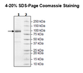 DPP4, His-tag Recombinant – Figure 1 of 4