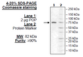 Prolyl Oligopeptidase/Prolyl Endopeptidase, His-tag Recombinant – Figure 1 of 2