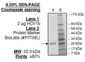 HCV1b, FLAG-His-tags Recombinant – Figure 1 of 2