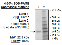 HCV1b, FLAG-His-tags Recombinant – Figure 1 of 2