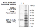 HCV2a, FLAG-His-tags Recombinant – Figure 1 of 2