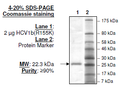 HCV1b (R155K), FLAG-His-tags Recombinant – Figure 1 of 2