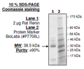 Rat Renin, His-tag Recombinant – Figure 1 of 2