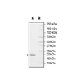 UbcH5b, His-Tag (Human) Recombinant – Figure 1 of 3