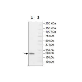 UbcH5b, His-Tag (Human) Recombinant – Figure 1 of 3