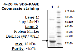 UbcH7, His-tag (E. coli-derived) Recombinant – Figure 1 of 2