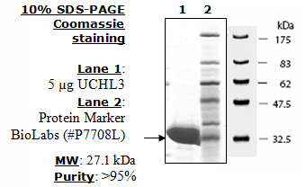 UCHL3, His-tag Recombinant – Figure 1 of 2