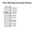 A20, His tag, FLAG-tag (Sf9-derived) Recombinant – Figure 1 of 2