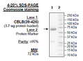CBL-B, GST-Tag (Human) Recombinant – Figure 1 of 2