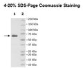 PARP14, His-GST-Tag Recombinant – Figure 1 of 2