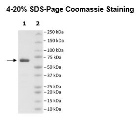 PARP14, His-GST-Tag Recombinant – Figure 1 of 2