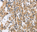 GAB1 Polyclonal Antibody – Figure 1 of 3