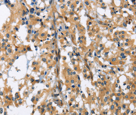 GAB1 Polyclonal Antibody – Figure 1 of 3