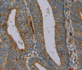 PYY Polyclonal Antibody – Figure 1 of 3