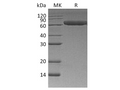 Recombinant Human ROR1 Protein (His Tag) – Figure 1 of 2