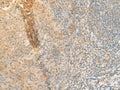 GPT2 Polyclonal Antibody – Figure 1 of 2