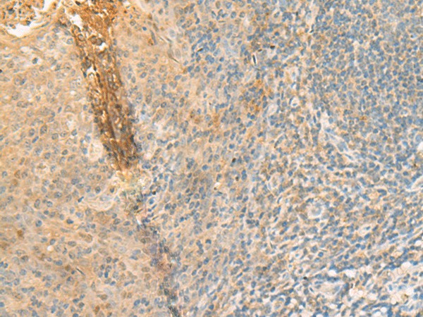 GPT2 Polyclonal Antibody – Figure 1 of 2