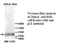 Anti-p21 Antibody – Figure 1 of 1