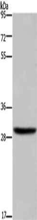 DHRS3 Polyclonal Antibody – Figure 1 of 3