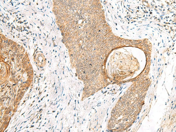 TOR1A Polyclonal Antibody – Figure 1 of 3