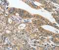 ANKZF1 Polyclonal Antibody – Figure 1 of 2