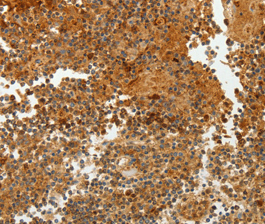 TFF2 Polyclonal Antibody – Figure 1 of 3