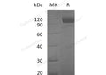 Recombinant Mouse TYRO3/DTK Protein (Fc Tag) – Figure 1 of 2