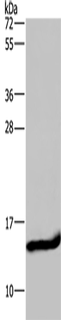 FABP2 Polyclonal Antibody – Figure 1 of 4