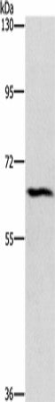 CERKL Polyclonal Antibody – Figure 1 of 2