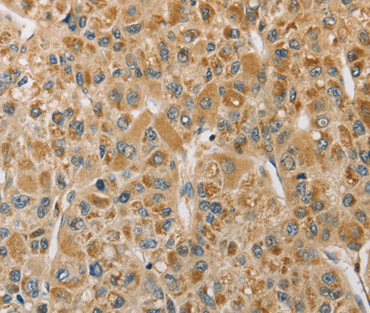 MIP Polyclonal Antibody – Figure 1 of 3