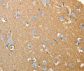 SLC4A4 Polyclonal Antibody – Figure 1 of 3